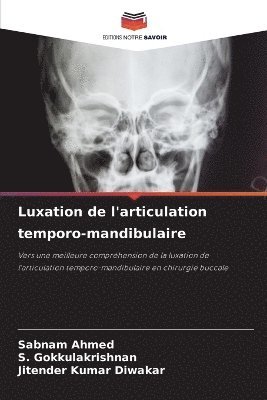 Sabnam Ahmed, S Gokkulakrishnan, Jitender Kumar Diwakar, S. Gokkulakrishnan, SABNAM AHMED - Luxation de l'articulation temporo-mandibulaire, Häftad