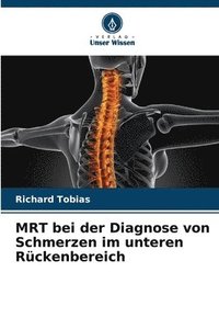 bokomslag MRT bei der Diagnose von Schmerzen im unteren Rckenbereich