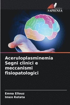 Aceruloplasminemia Segni clinici e meccanismi fisiopatologici 1