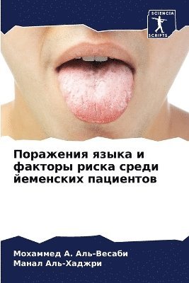 Поражения языка и факторы риска среди йем&#107