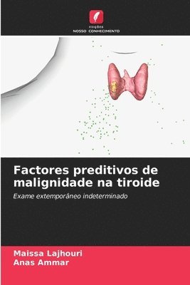 Factores preditivos de malignidade na tiroide 1