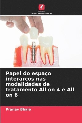 Papel do espao interarcos nas modalidades de tratamento All on 4 e All on 6 1