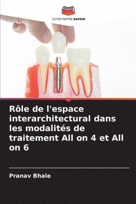 Pranav Bhale - Rôle de l'espace interarchitectural dans les modalités de traitement All on 4 et All on 6, Häftad