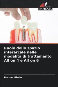 bokomslag Ruolo dello spazio interarcale nelle modalit di trattamento All on 4 e All on 6