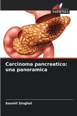 bokomslag Carcinoma pancreatico