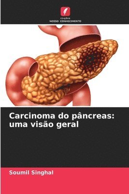 bokomslag Carcinoma do pncreas