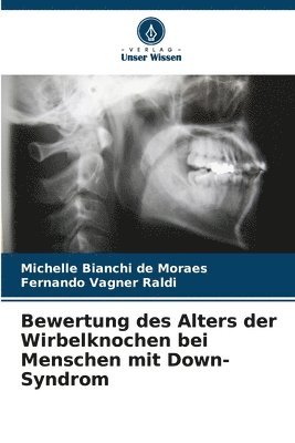 bokomslag Bewertung des Alters der Wirbelknochen bei Menschen mit Down-Syndrom