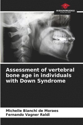 bokomslag Assessment of vertebral bone age in individuals with Down Syndrome