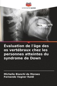 bokomslag valuation de l'ge des os vertbraux chez les personnes atteintes du syndrome de Down