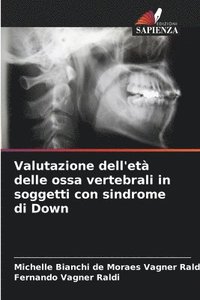 bokomslag Valutazione dell'età delle ossa vertebrali in soggetti con sindrome di Down