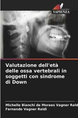 Michelle Bianchi de Moraes Vagner Raldi, Fernando Vagner Raldi - Valutazione dell'età delle ossa vertebrali in soggetti con sindrome di Down, Häftad