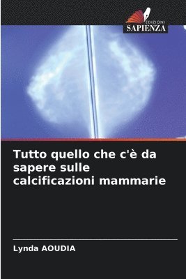 bokomslag Tutto quello che c'è da sapere sulle calcificazioni mammarie