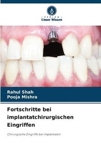 bokomslag Fortschritte bei implantatchirurgischen Eingriffen