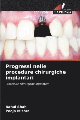 bokomslag Progressi nelle procedure chirurgiche implantari