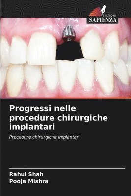 Rahul Shah, Pooja Mishra, RAHUL SHAH - Progressi nelle procedure chirurgiche implantari, Häftad