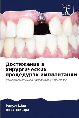 Рахул Шах, Пооя Мишра, &#1056;&#1072;&#1 &#1064;&#1072;&#1093;, &#1 &#1052;&#1080;&#1096;&#1088;&#1072;, ¿¿¿¿¿ ¿¿¿, ¿¿¿¿ ¿¿¿¿¿ - Достижения в хирургических процедурах им, Häftad