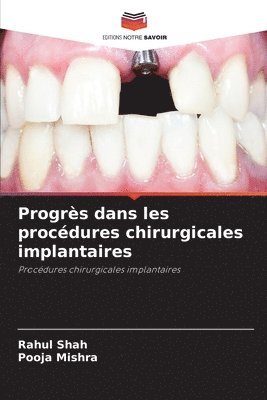 Rahul Shah, Pooja Mishra, RAHUL SHAH - Progrès dans les procédures chirurgicales implantaires, Häftad