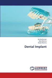 bokomslag Dental Implant