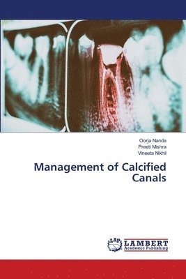 bokomslag Management of Calcified Canals