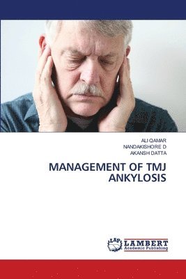 Management of Tmj Ankylosis 1