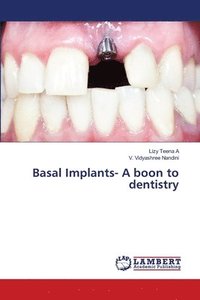 bokomslag Basal Implants- A boon to dentistry