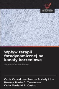 bokomslag Wplyw terapii fotodynamicznej na kanaly korzeniowe