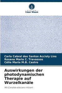 bokomslag Auswirkungen der photodynamischen Therapie auf Wurzelkanäle