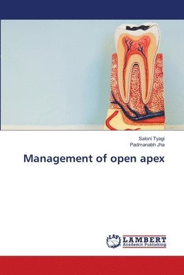 Management of open apex 1