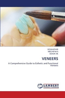 Vedavathi B, Nischitha A, Ashok Hk, VEDAVATHI B, NISCHITHA A - Veneers, Häftad