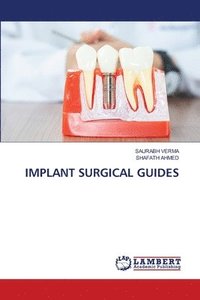 bokomslag Implant Surgical Guides