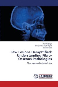 bokomslag Jaw Lesions Demystified: Understanding Fibro-Osseous Pathologies