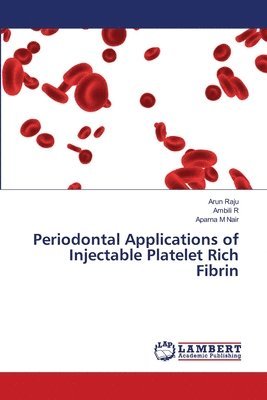 Arun Raju, Ambili R, Aparna M Nair - Periodontal Applications of Injectable Platelet Rich Fibrin, Häftad