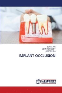 bokomslag Implant Occlusion