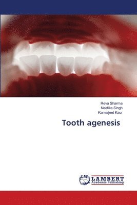 bokomslag Tooth agenesis