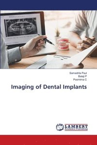 bokomslag Imaging of Dental Implants