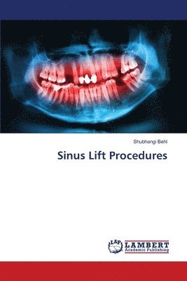 bokomslag Sinus Lift Procedures