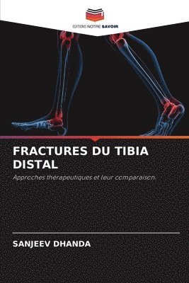 bokomslag Fractures Du Tibia Distal