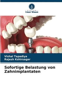 bokomslag Sofortige Belastung von Zahnimplantaten