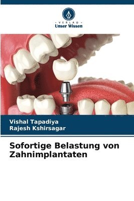 Sofortige Belastung von Zahnimplantaten 1