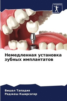 Вишал Тападия, Раджеш Кширсагар, &#1058;&#1072;&#1087;&#1072;&#1076;&#108, &#1050;&#1096;&#1080;&#1088;&#1089;&#107, ¿¿¿¿¿ ¿¿¿¿¿¿¿, ¿¿¿¿¿¿ ¿¿¿¿¿¿¿¿¿ - Немедленная установка зубных имплантато&, Häftad