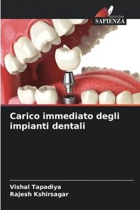 bokomslag Carico immediato degli impianti dentali