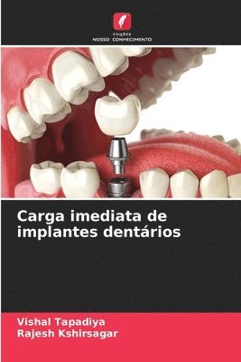 bokomslag Carga imediata de implantes dentrios