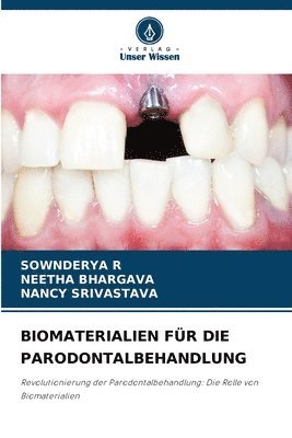 Biomaterialien Für Die Parodontalbehandlung