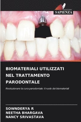 bokomslag Biomateriali Utilizzati Nel Trattamento Parodontale