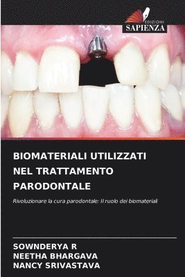 Biomateriali Utilizzati Nel Trattamento Parodontale 1