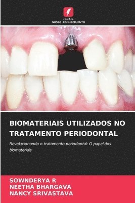 Sownderya R, Neetha Bhargava, Nancy Srivastava, SOWNDERYA R, NEETHA BHARGAVA - Biomateriais Utilizados No Tratamento Periodontal, Häftad