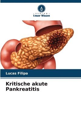 bokomslag Kritische akute Pankreatitis