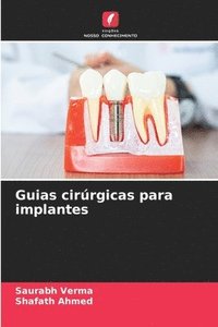 bokomslag Guias cirrgicas para implantes