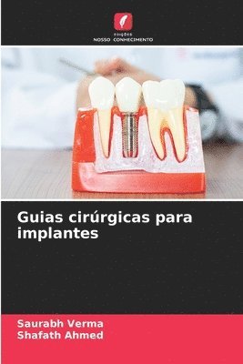 bokomslag Guias cirrgicas para implantes