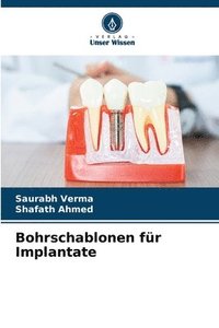 bokomslag Bohrschablonen fr Implantate